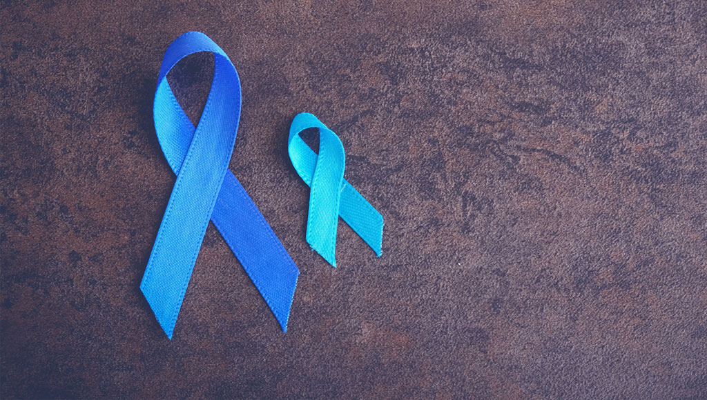 Cáncer de colon: lo que tienes que saber