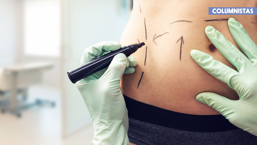 ¿Liposucción o tres meses de dieta y gym?