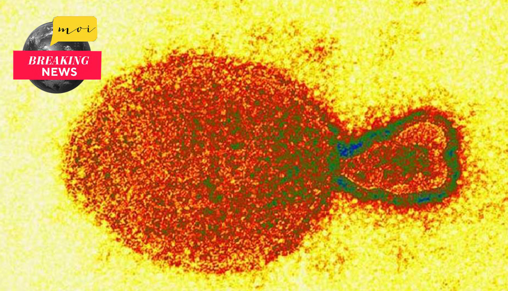 Breaking: ¿Otra pandemia? Henipavirus, el nuevo virus de China