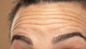 ¿Cómo eliminar las arrugas con ejercicio? ¡Sin agujas, sin drama!