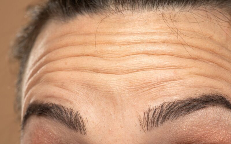 ¿Cómo eliminar las arrugas con ejercicio? ¡Sin agujas, sin drama!