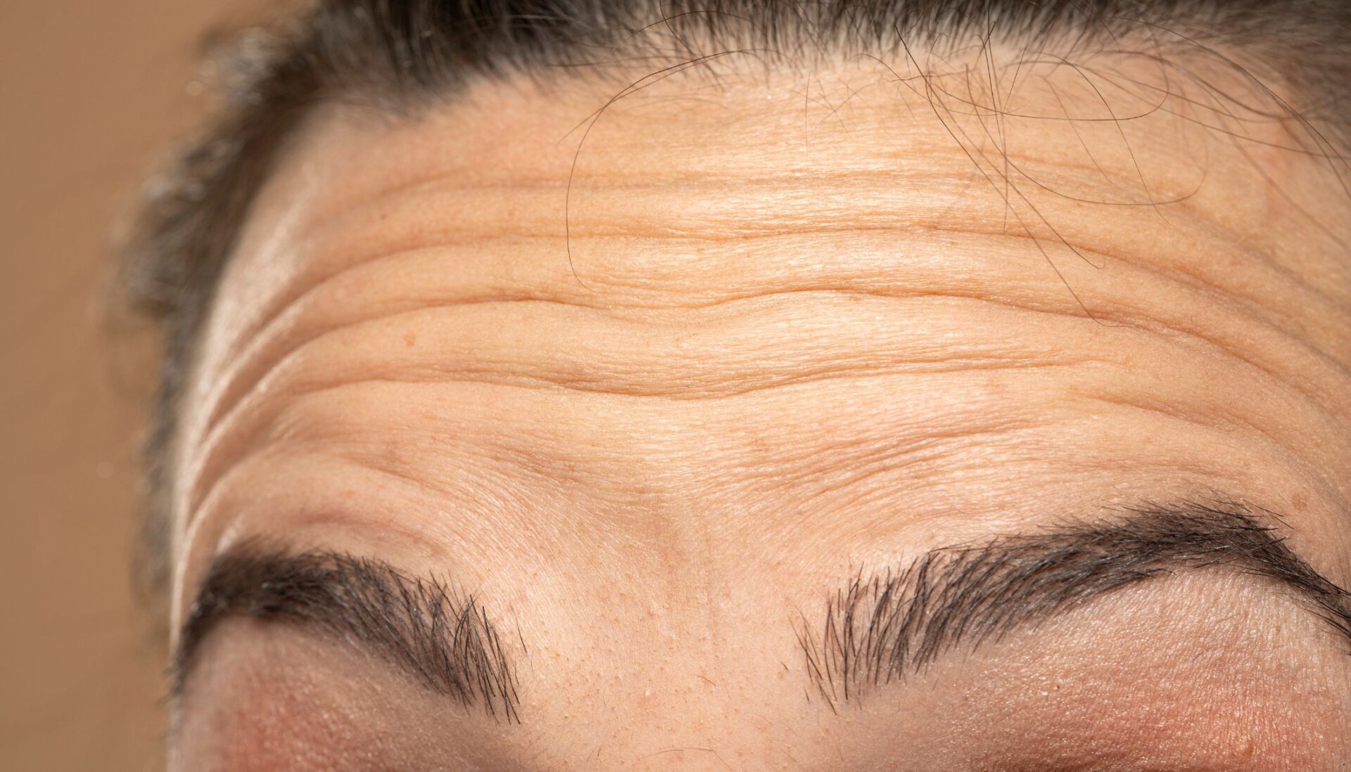 ¿Cómo eliminar las arrugas con ejercicio? ¡Sin agujas, sin drama!