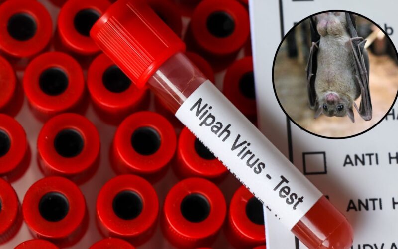 Virus Nipah: La nueva amenaza de salud
