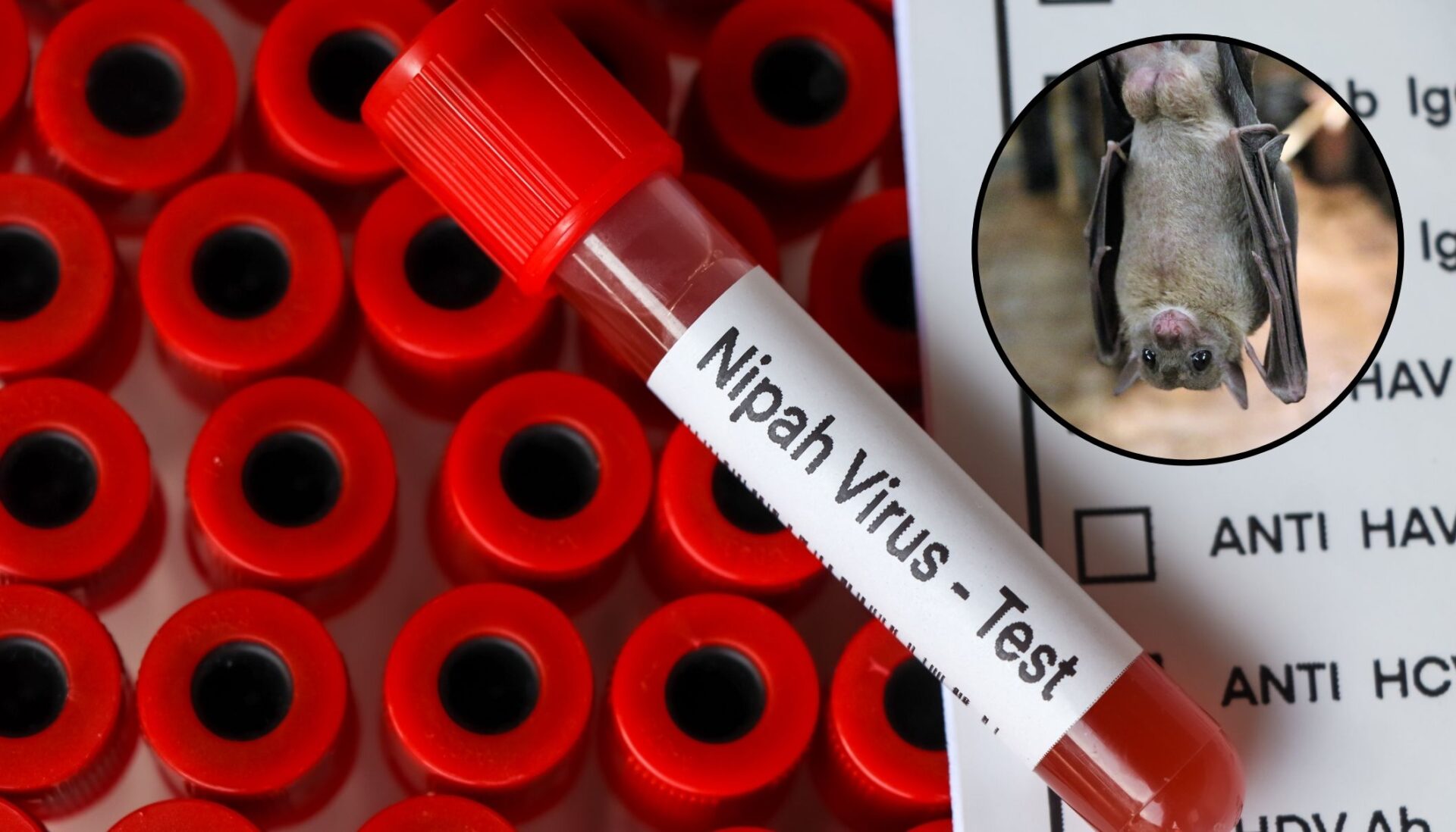 Virus Nipah: La nueva amenaza de salud
