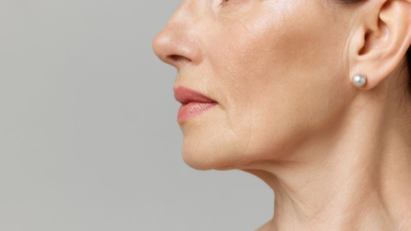 Elimina las arrugas de tu cara con EMFACE