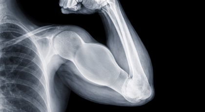 5 alimentos que pueden fortalecer tus huesos más que la leche ¡Pa’ crecer fuertototote!