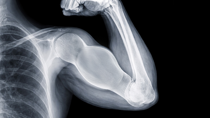 5 alimentos que pueden fortalecer tus huesos más que la leche ¡Pa’ crecer fuertototote!