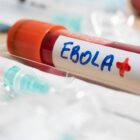 Ojo aquí: El checklist de salud antes de viajar al Mundial 2026